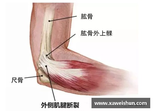 beat365体育官网球员跟腱拉伤：预防与康复策略详解 - 副本